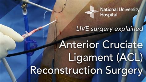 acl surgery greenwich|ACL surgery .
